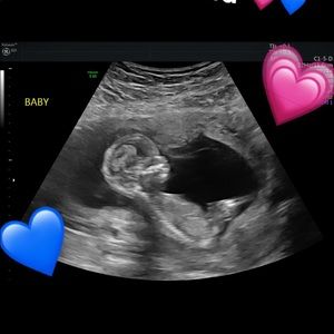 Meet your Posher, Kylie